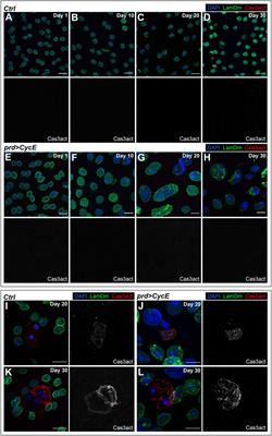 Cyclin E overexpression in the Drosophila accessory gland induces tissue dysplasia